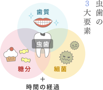 虫歯の三大要素